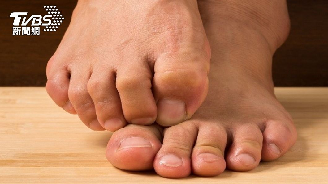 甲床鱗狀細胞癌好發於50~70歲男性,最常發生部位是拇指及大腳趾。(示意圖/shutterstock達志影像)