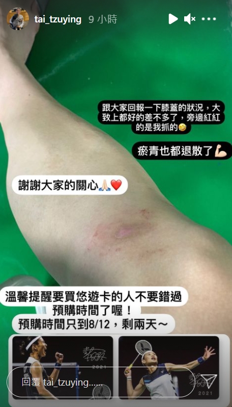 戴資穎自拍傷勢,向球迷報平安。(圖/翻攝自 tai_tzuying IG)