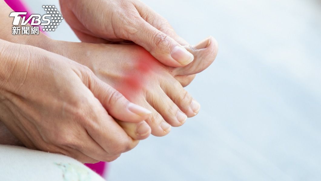 尿酸過高代謝異常,恐引發痛風問題。(示意圖/shutterstock達志影像)
