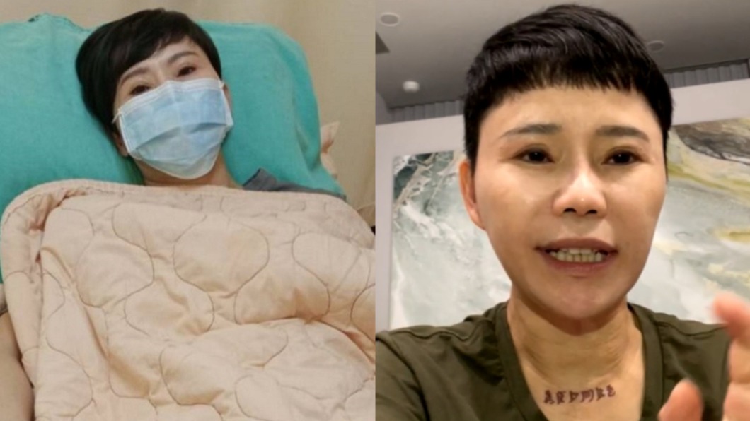 罹帕金森氏症頭髮狂掉　詹雅雯被嗆「整形炒新聞」吐心酸