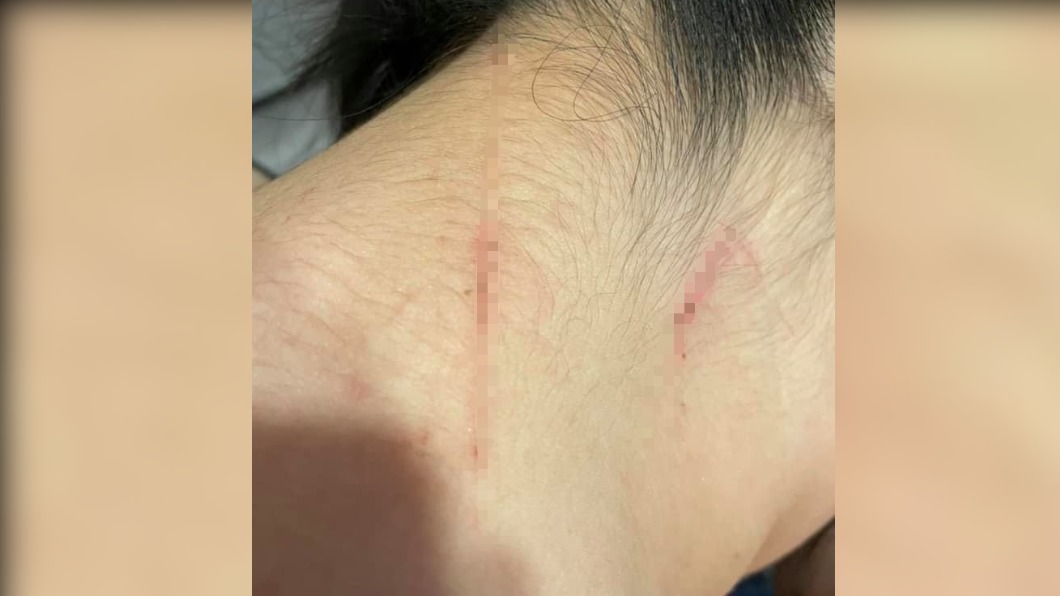 李姓女子遭毆打受傷。（圖／翻攝自爆料公社二社）