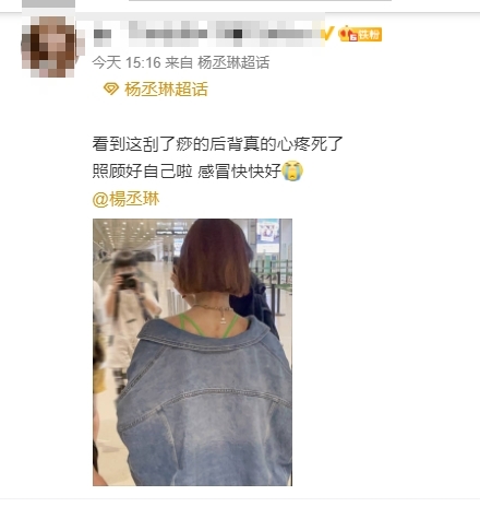 楊丞琳現身機場背部有刮痧痕跡,粉絲心疼。(圖/翻攝自微博)