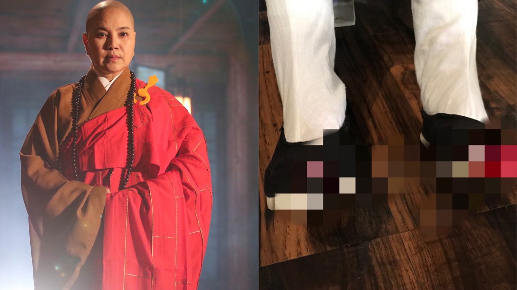 行腳2萬里受重傷？57歲唐美雲「雙腳爆血照」太驚悚