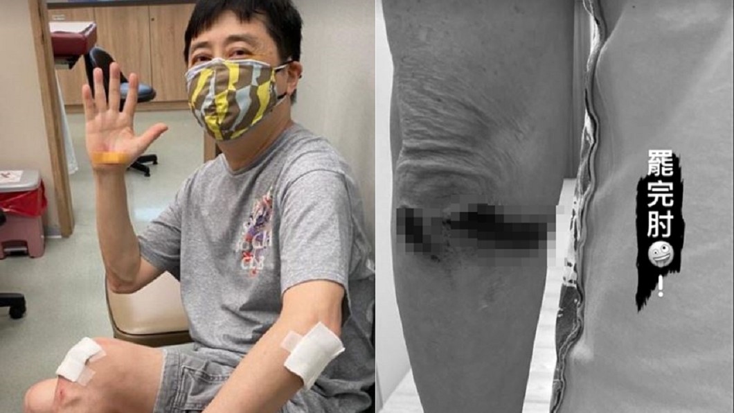 庾澄慶車禍！雷殘「手腳全是血」急送醫　恐怖傷勢曝光