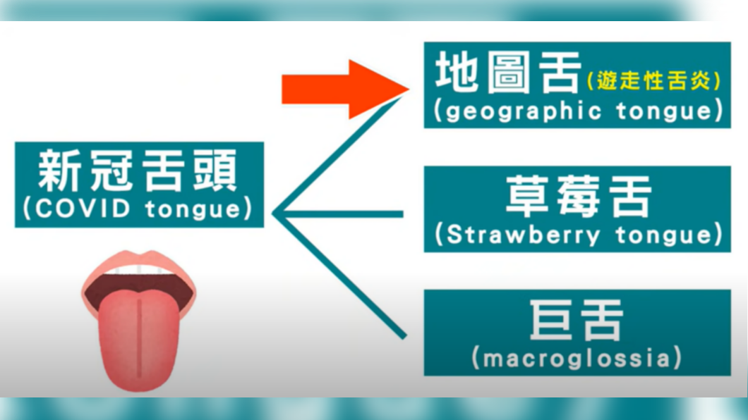 新冠舌頭包括地圖舌、草莓舌與巨舌。(圖/翻攝自京硯聯合診所整形外科 / 皮膚科YouTube)