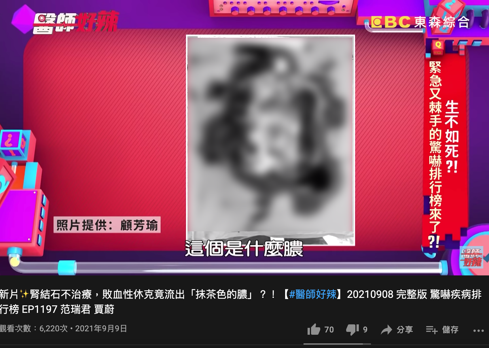 整顆腎被細菌吃爛,剩糊糊的一團肉。(圖/翻攝自《醫師好辣》YouTube)