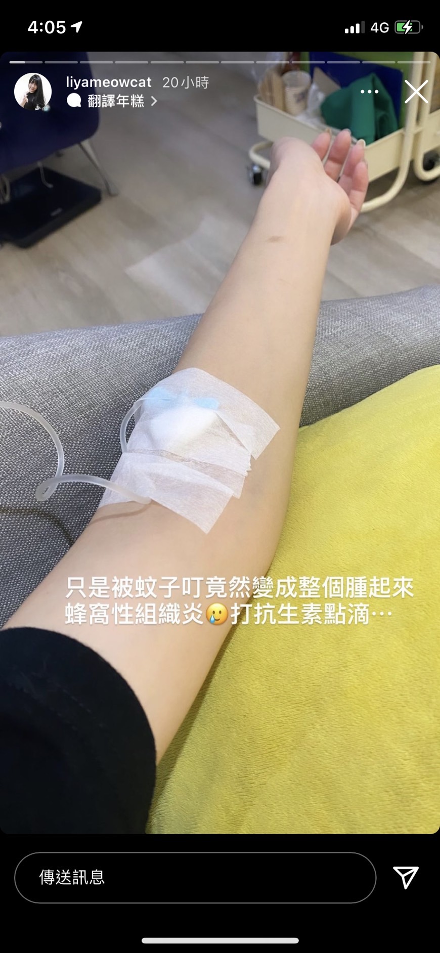 莉婭被蚊子叮咬。（圖／翻攝自莉婭Instagram）