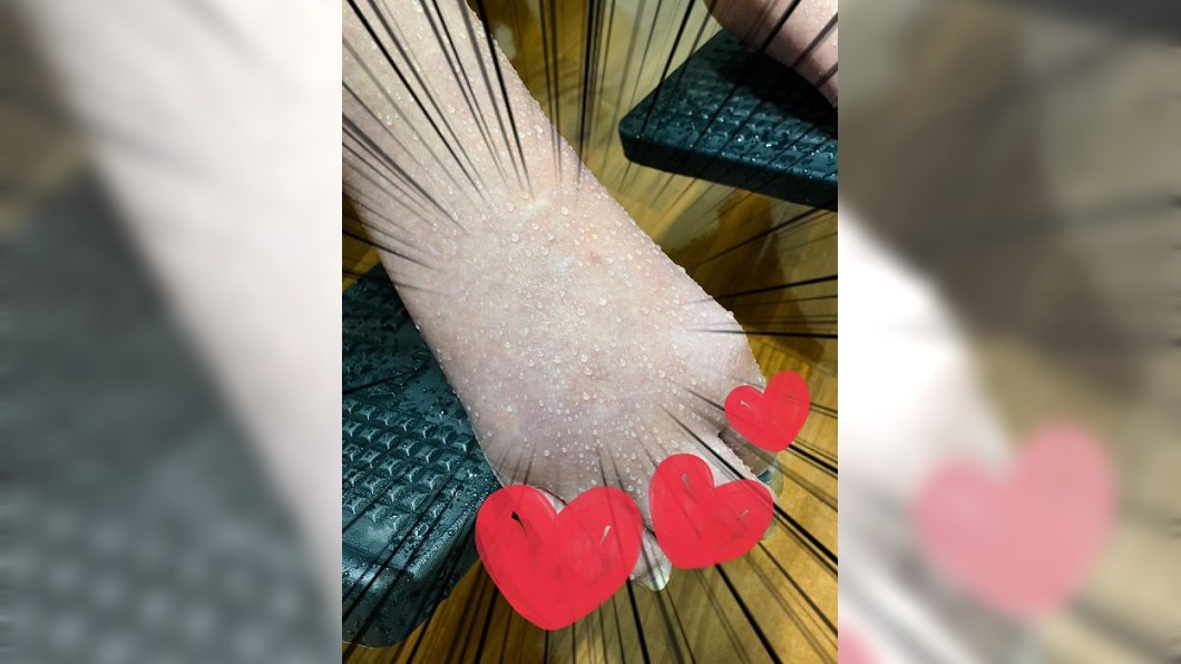 阿嬤腳滲出水珠。（圖／翻攝自吳欣岱Facebook）