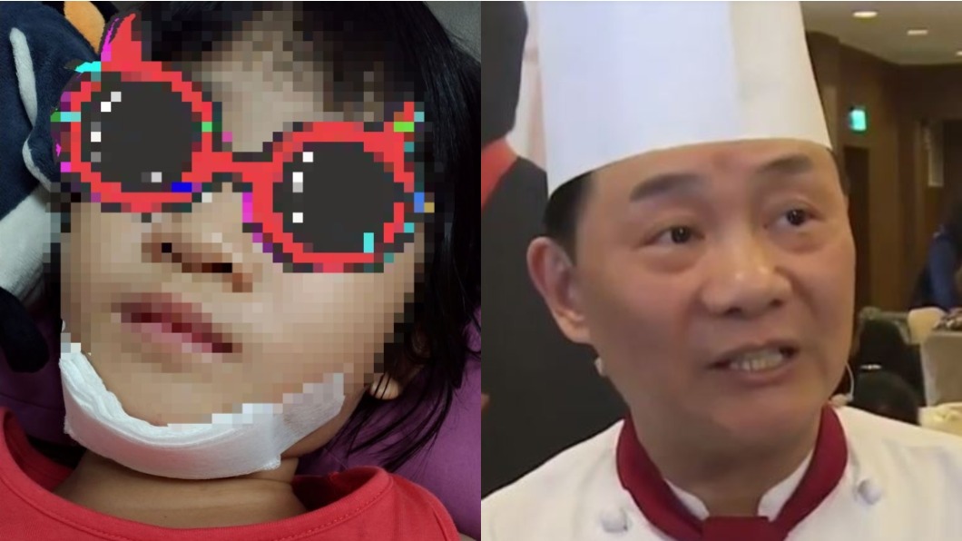 女童玩太嗨摔破下巴!家長急奔飯店求助「他」暖心呼呼