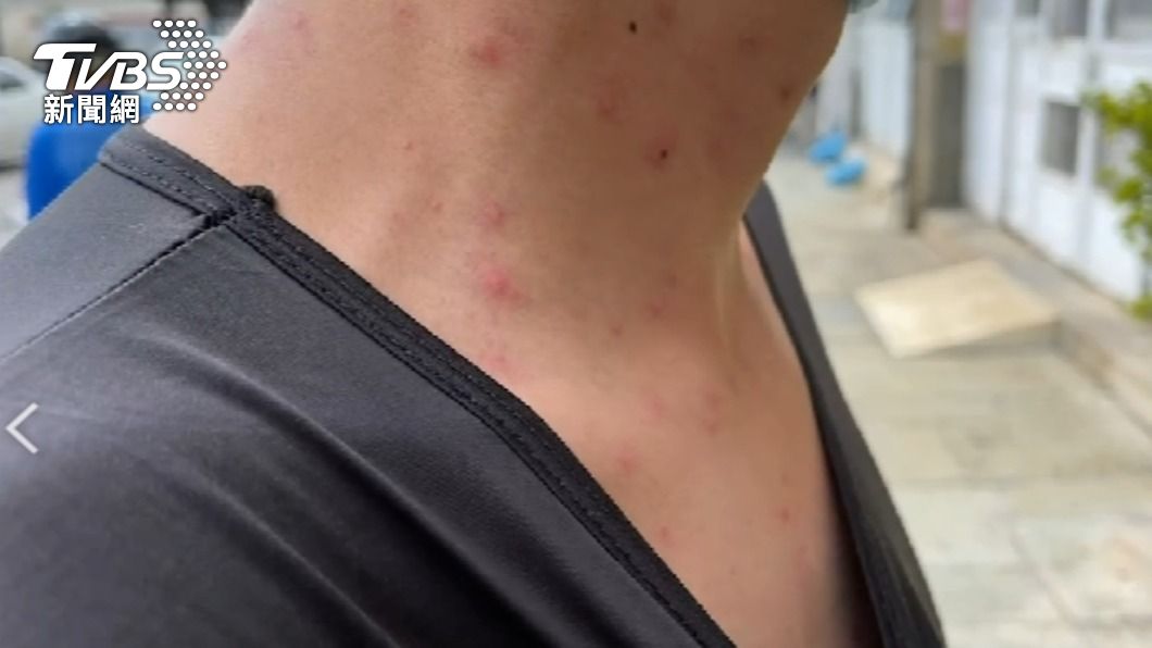 澎湖百人長小紅疹超癢！抓到「凶手」了　黃毒蛾惹禍