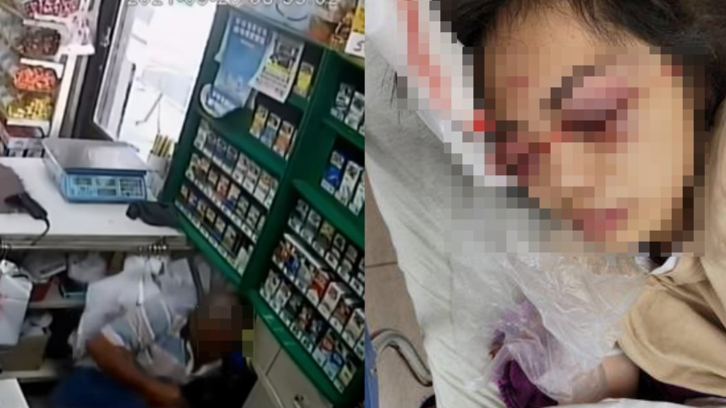 屏東一名男子攻擊女店員的眼睛。(圖/翻攝自爆料公社)