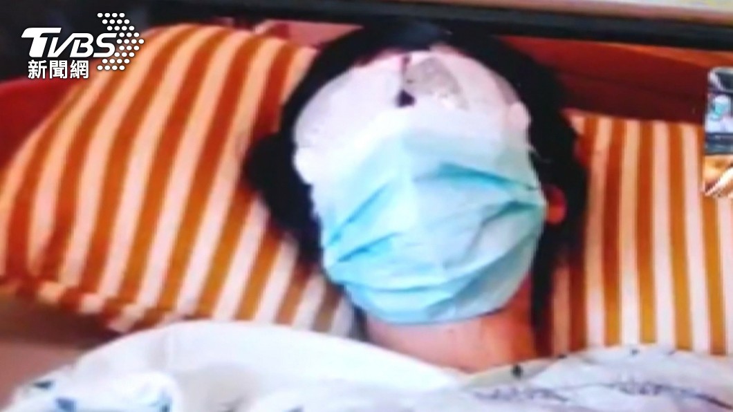 遭戳眼女店員「恐失明、破相」 驚嚇過度難眠將精神治療