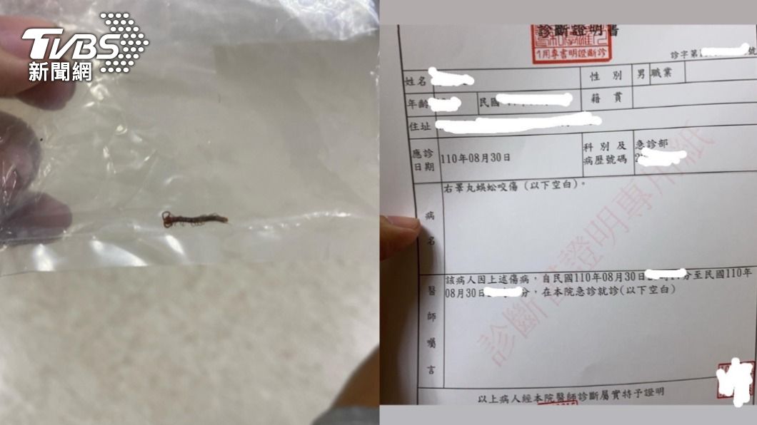 裸睡遭蜈蚣啃蛋!他「痛爆滾地」尷尬看診:比中樂透稀有