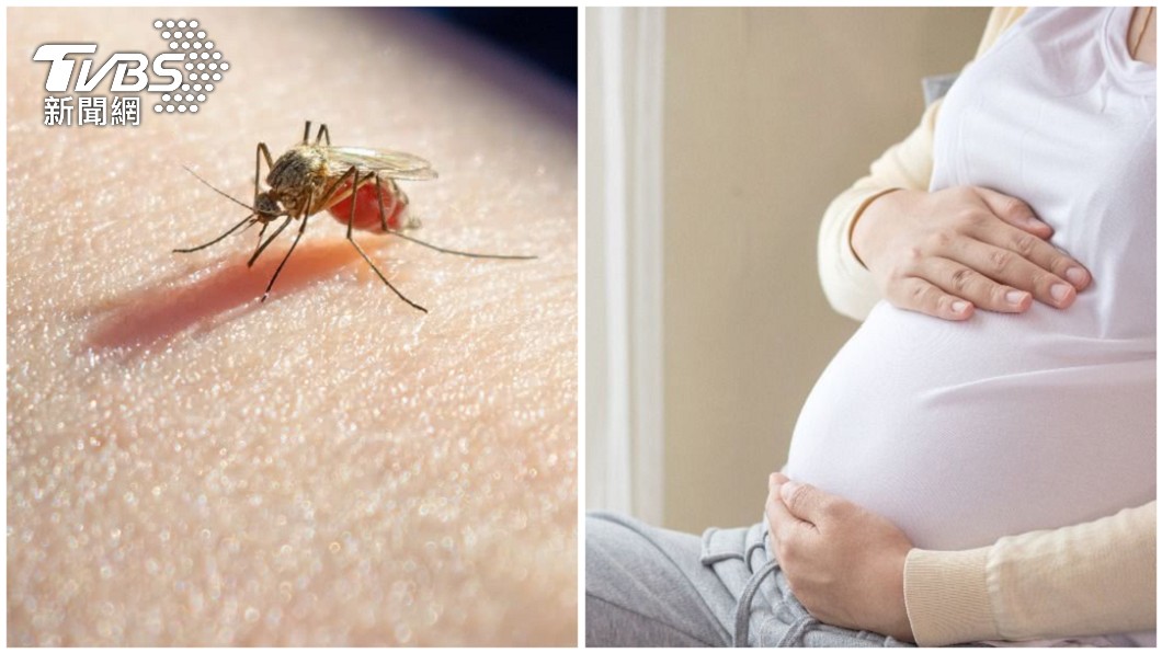 孕婦左小腿腫脹原因竟是被蚊子叮後造成的。(合成示意圖/shutterstock達志影像)