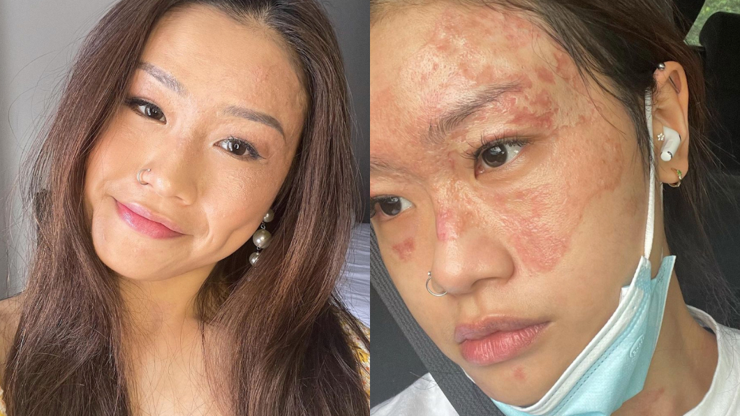 前男友因心理壓力問題,選擇結束2人的關係。(圖/翻攝自charlenechew IG)
