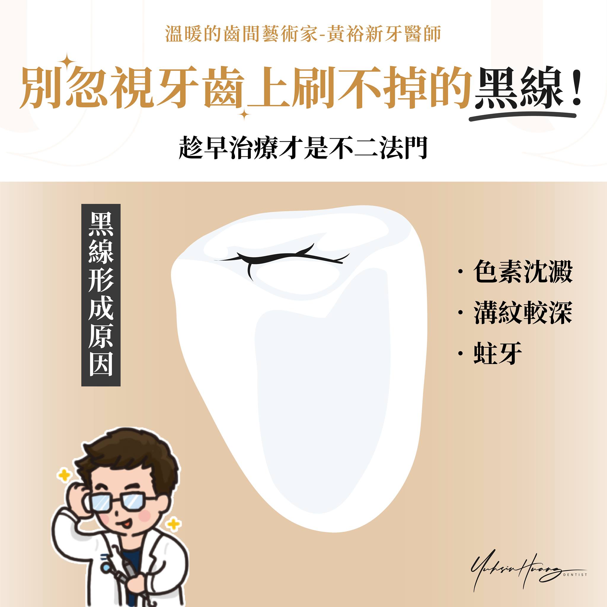 醫師提醒別忽視牙齒上刷不掉的黑線。(圖/翻攝自黃裕新臉書)