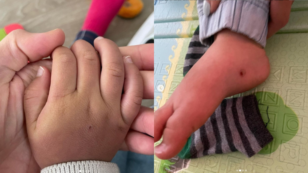 孩子手腳有明顯外傷傷痕。（圖／翻攝自鄭爽IG）