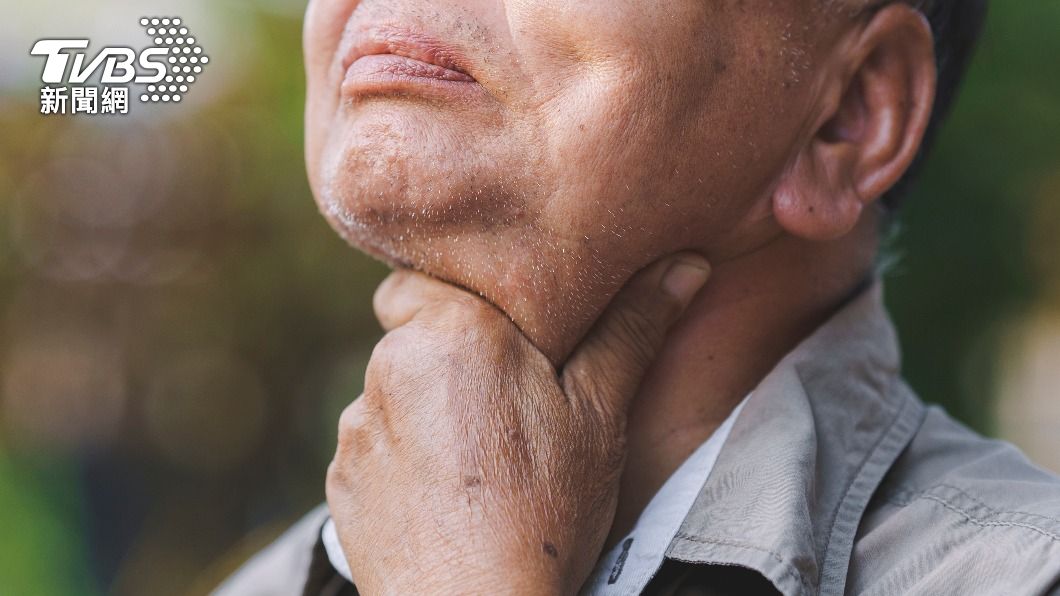 安布羅斯罹患喉癌末期,卻奇蹟痊癒。(示意圖/shutterstock 達志影像)