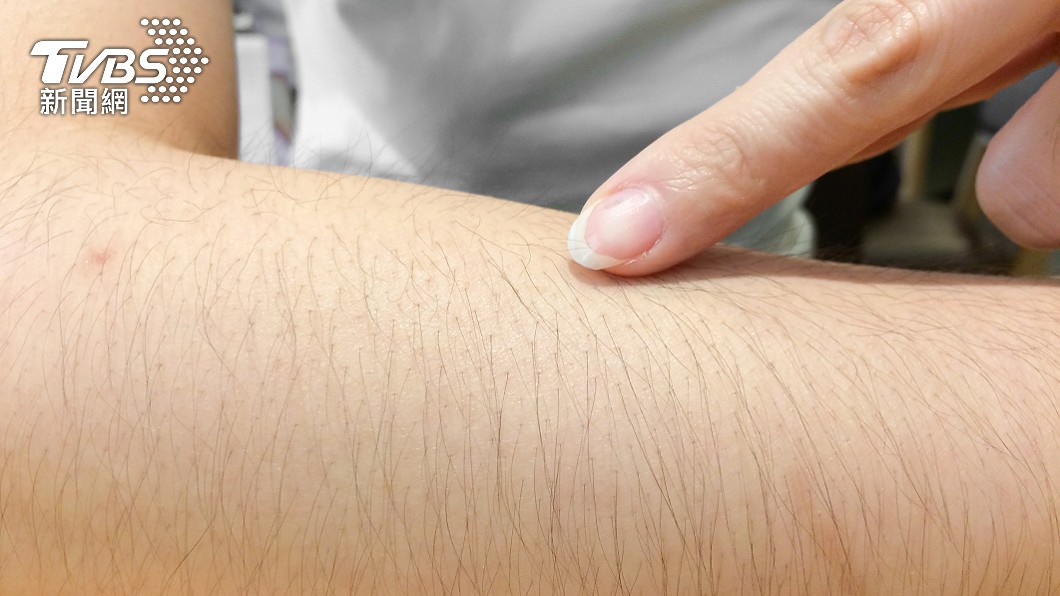 體毛太多被分手!媽寶男嘆「我媽說妳不乾淨」 網一面倒:分得好