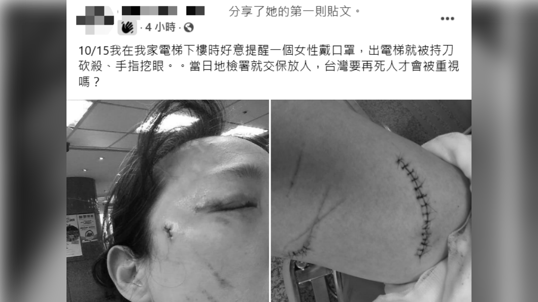 王女發文控訴自己遭鄰居持刀攻擊。（圖／翻攝自爆料公社公開版）