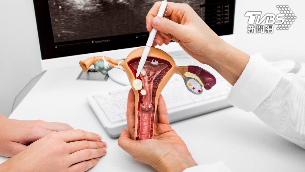 女性應定期做抹片檢查。(示意圖/shutterstock達志影像)