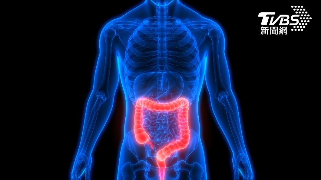 消化道大腫瘤不一定要開腹式手術切除。（示意圖／shutterstock達志影像）