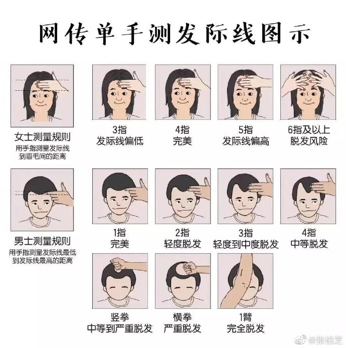 網傳單手測髮際線圖示。(圖/翻攝自張柏芝微博)