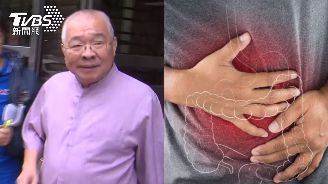 朱高正癌逝!大腸癌奪命「有這症狀」快就醫 好發年齡曝
