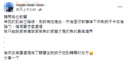一名男子分享,在岸邊準備拋鉤釣魚時,不小心甩到自己的後腦勺。(圖/翻攝自爆廢公社公開版臉書)