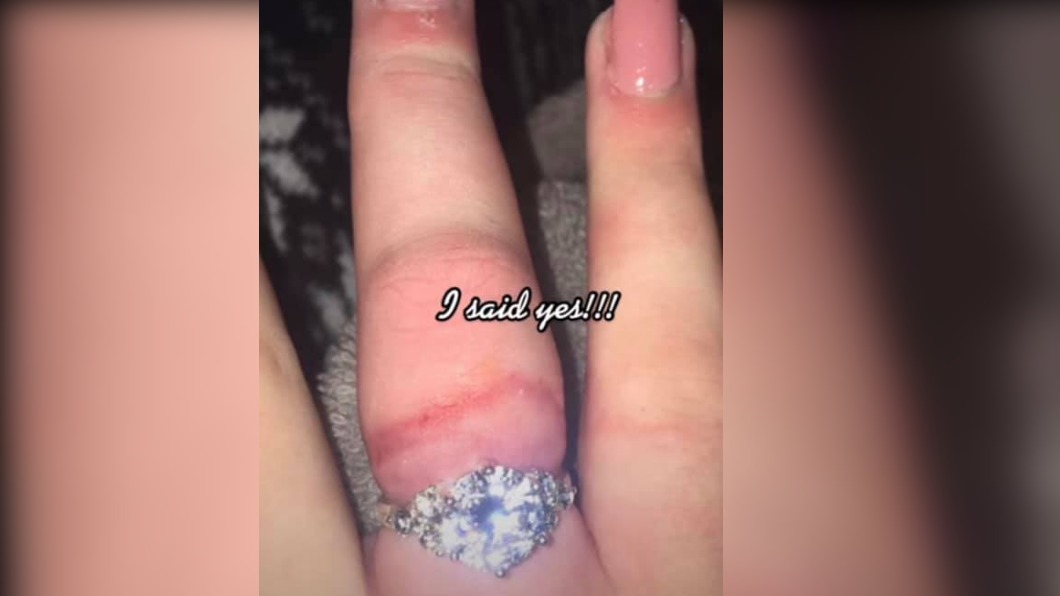 糗!她曬超浮誇訂婚鑽戒閃瞎眾人 網揭1亮點尷尬了