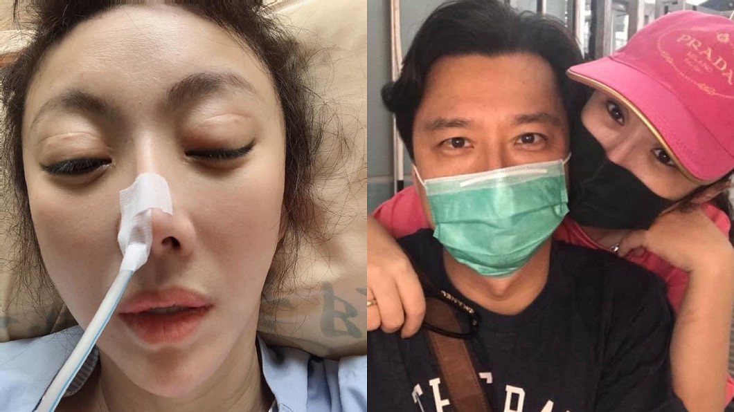 腸爆裂插管病危!女星「今腹部清創」引流綠糞尪求集氣