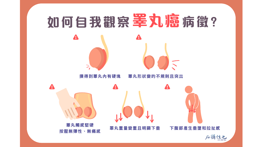 睪丸癌自我檢測5大病徵。（圖／翻攝自石•攝•性•也 泌尿科 陳鈺昕醫師臉書）