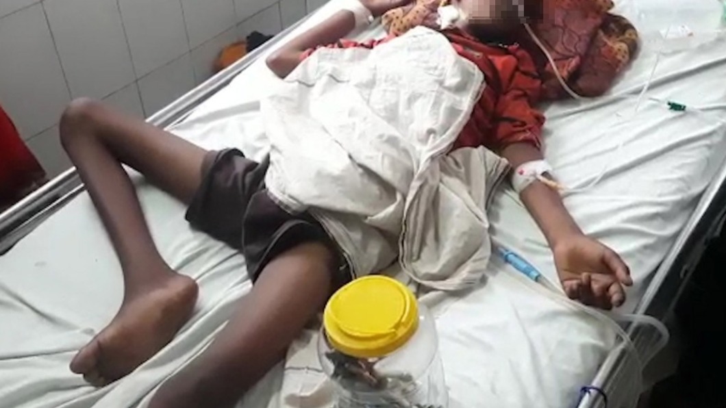 肚子是百寶袋?少年吞16支牙刷、鐵釘 家屬竟稱避邪用