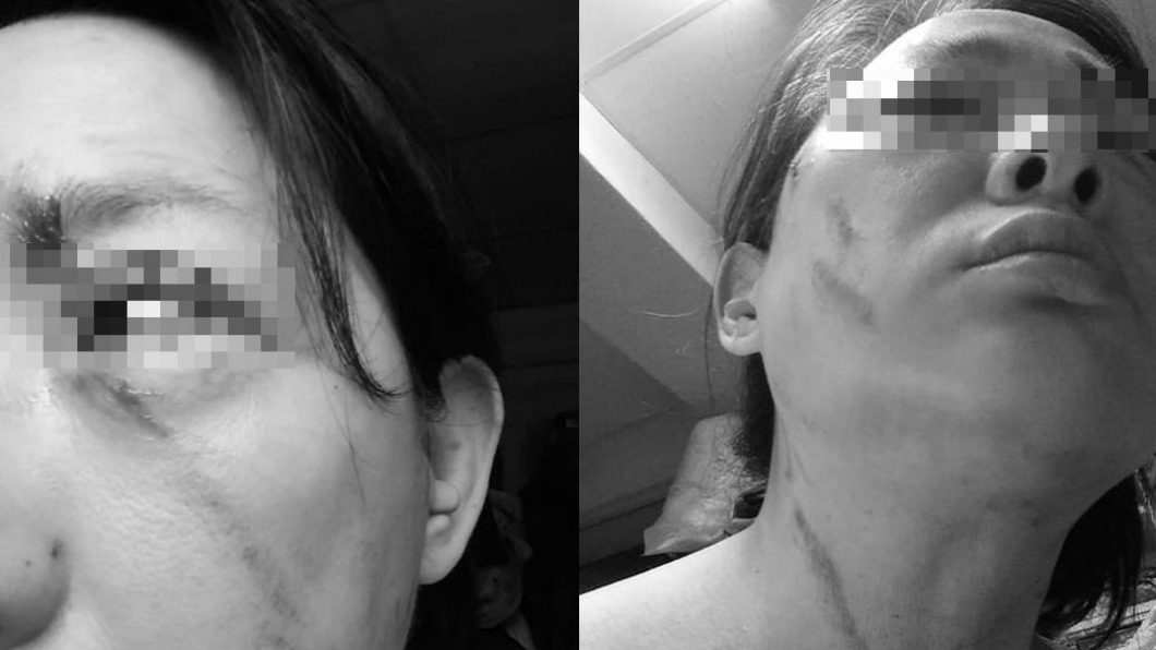 同是「勸戴口罩」被戳眼!北市女控乏人問津 盼嚴辦嫌犯