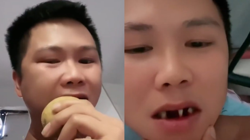 抗戰片《長津湖》啃凍馬鈴薯!陸男好奇跟風慘拔3顆牙