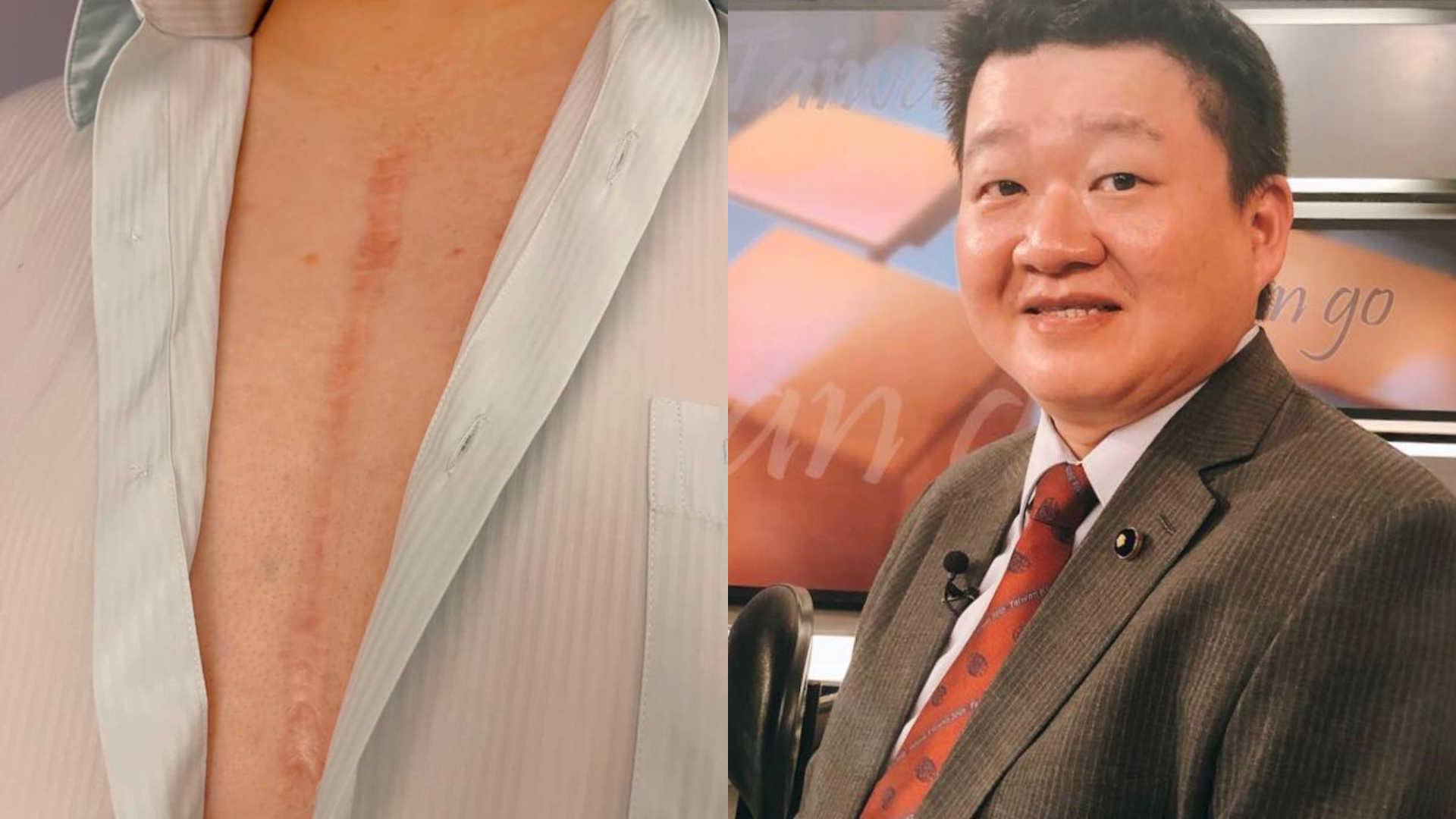 何博文嗆侯友宜卑劣 他看不下去打臉:2次心臟手術照當兵