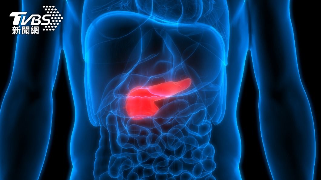胰臟癌死亡率95%　若出現「這症狀」快掛急診