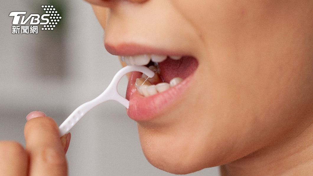 醫生指出，牙線有助於牙齒的健康。（示意圖／shutterstock達志影像）