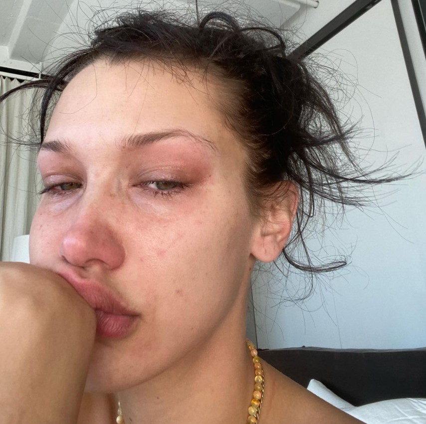 貝拉在IG上PO出憔悴淚崩照。(圖/翻攝自IG@bellahadid)