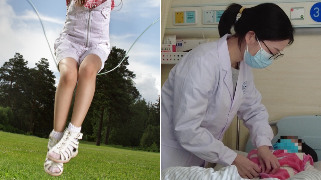 跳繩後腹痛狂吐 陸5歲女童送醫驚「卵巢扭轉720度」