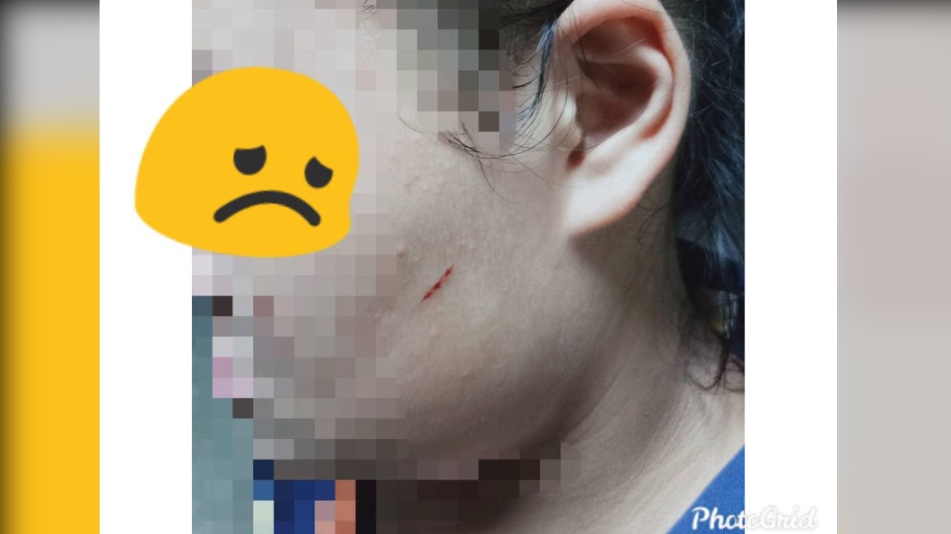 原PO姪女臉上都是傷。(圖/翻攝自屏東縣萬丹鄉交流地)