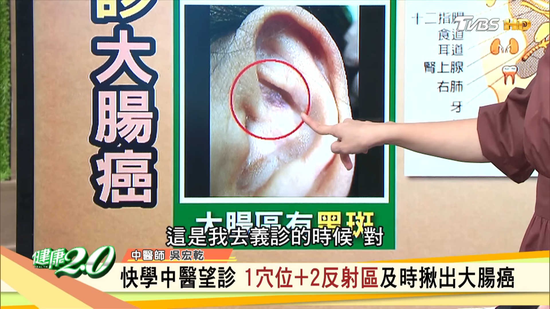 另一患者出現黑斑。(圖/TVBS)