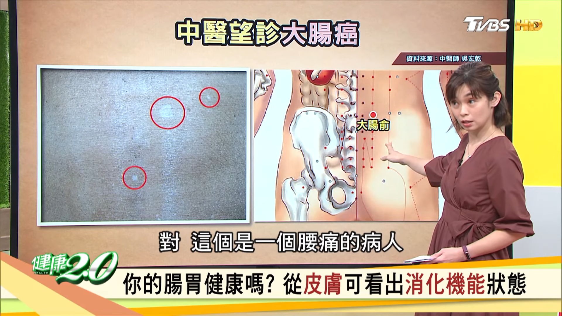 從背部「大腸俞」部位也可以看出端倪。(圖/TVBS)