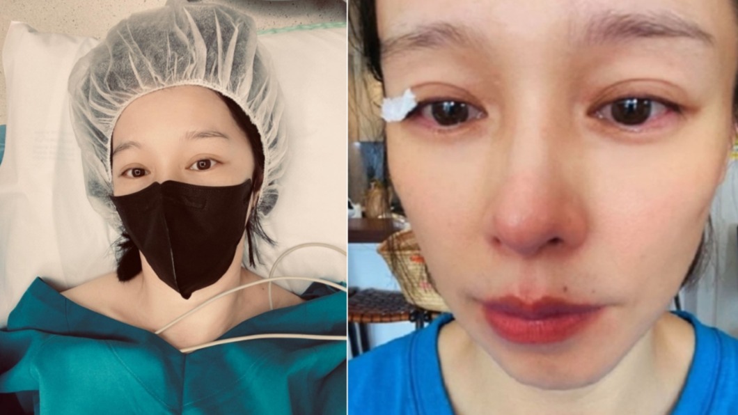 徐若瑄大量出血!有昏倒危險「子宮肌腺瘤變大」蒼白洩病況