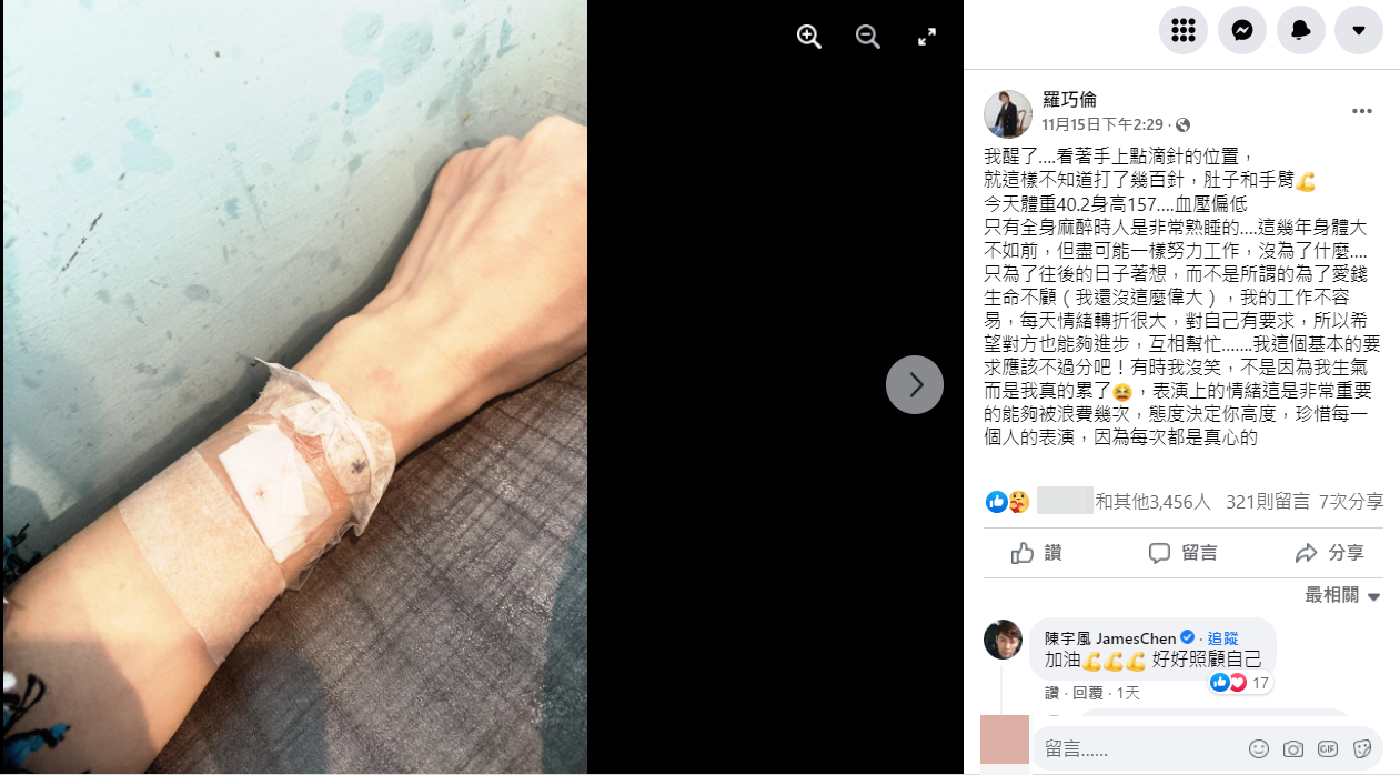 羅巧倫曬出手臂照片,上面滿是打針痕跡。(圖/翻攝自羅巧倫臉書)