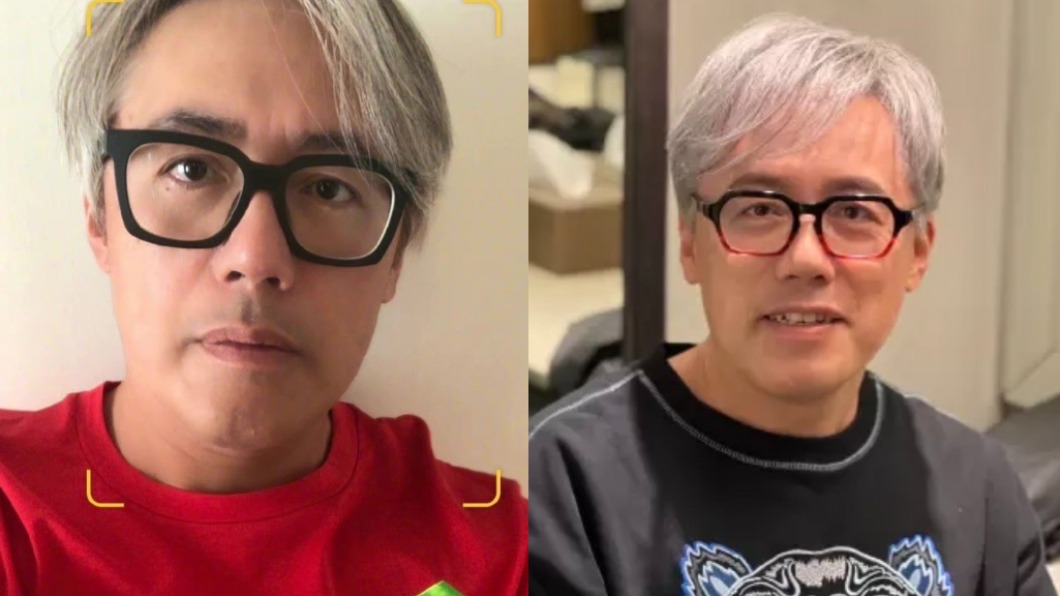 停工3年罕曝近況!張宇「滿頭白髮」粉絲嚇:怎麼了