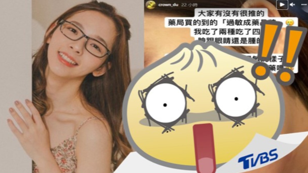 滴妹曝嚇人臉腫照! 紅癢、鼻塞「吃藥沒用」急求救