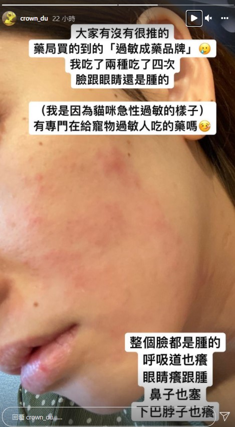 滴妹自曝因為貓咪急性過敏,和粉絲求救是否有推薦的成藥品牌。(圖/翻攝自IG@crown_du)
