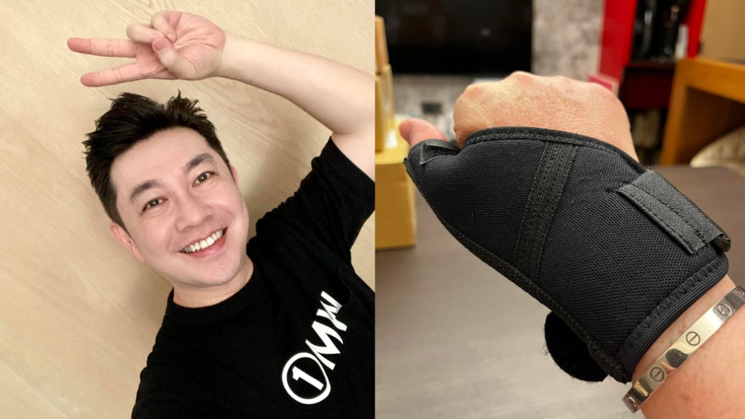 工作摧殘20年!名造型師右手發炎積水 塗精油慘灼傷