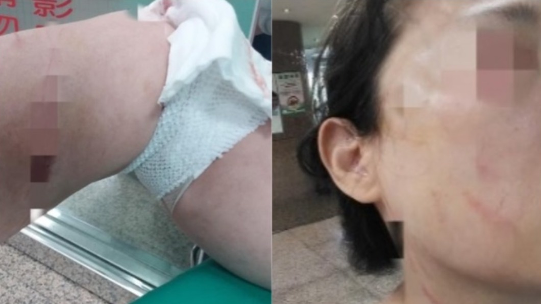 不滿被鄰提醒戴口罩!女持刀攻擊+戳眼 殺人未遂起訴